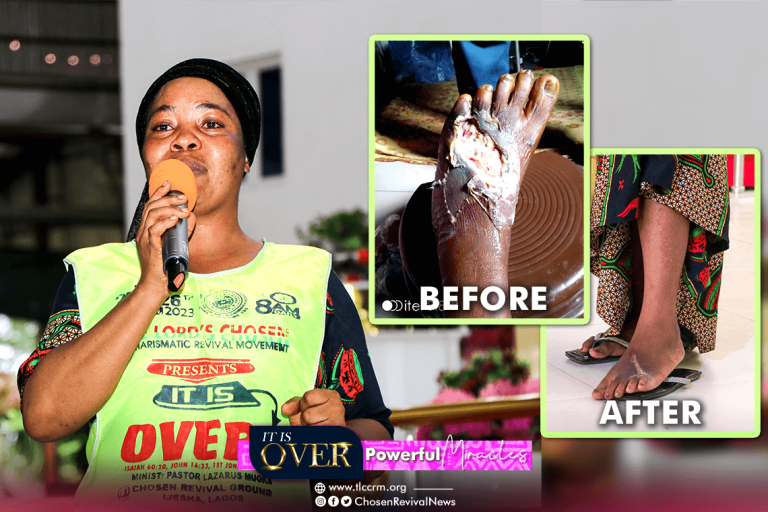 Leg Poison Healed - Sister Favour Francis